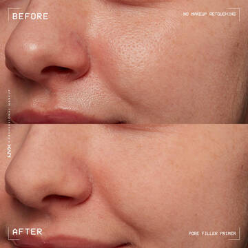 Pore Filler